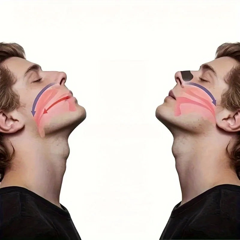 30PCS Anti-Snoring Nose Strips