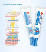 Anti-Acne Cream with Salicylic Acid