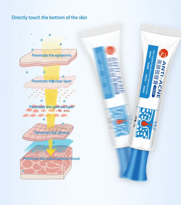 Anti-Acne Cream with Salicylic Acid