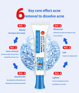 Anti-Acne Cream with Salicylic Acid